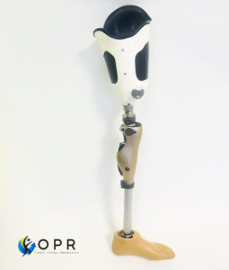 prothèse fémorale de hanche avec genou kenevo de chez ottobock disponible chez orthese prothese reeducation en normandie et en bretagne