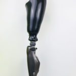prothèse fémorale en carbone avec genou mircroprocesseur c leg à Rennes en bretagne