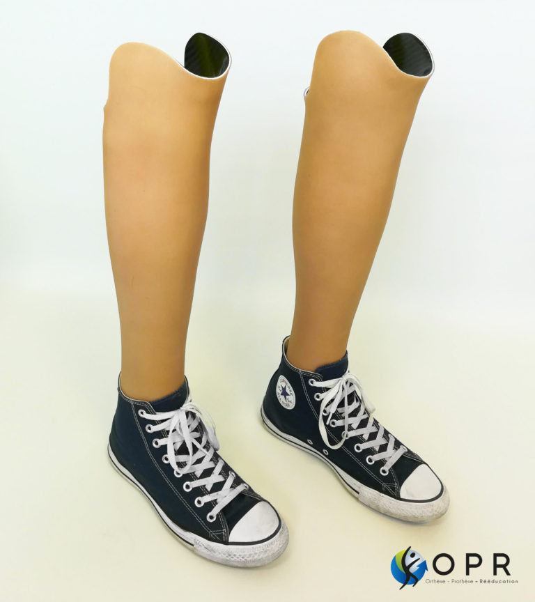 prothèses bilatérales de hanche pour amputé en carbone avec esthétique aqualeg en bretagne