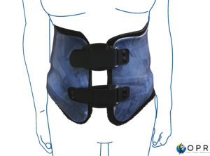 corset thermoformé, sur mesure par orthoprothésiste à Rennes et à Avranches, departements 50