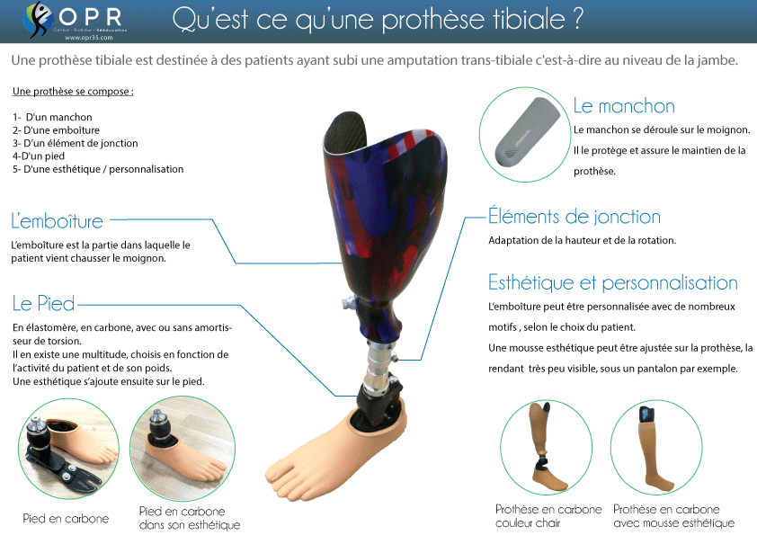 infographie qu'est ce qu'une prothèse tibiale what is prosthetic french france orthodic orthopédie rennes ile et vilaine