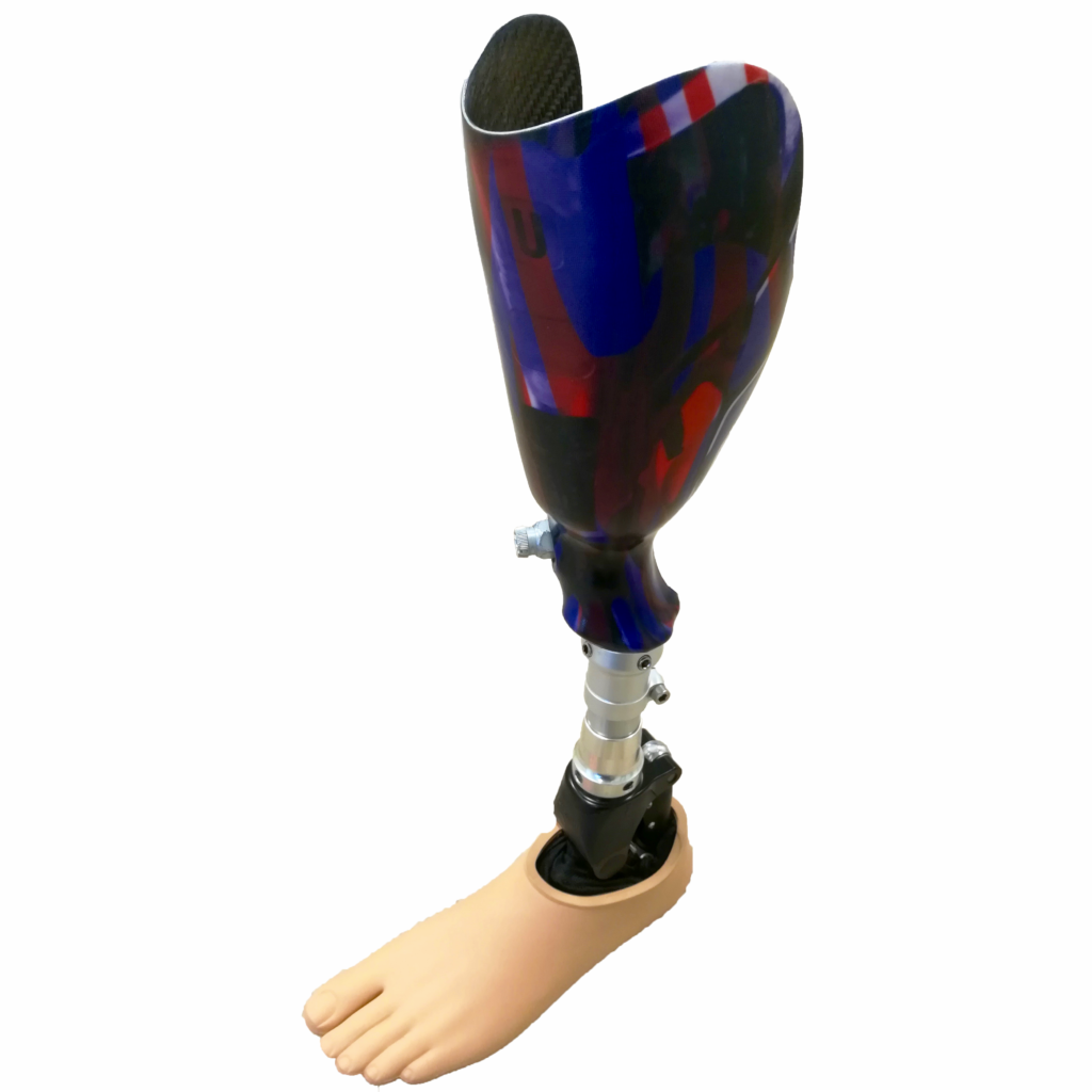 Prothèse de jambe en carbone OPR, fabriqué par nos orthoprothesistes en Ille-et-vilaine. Prothèse de tibia à Avrangces proche de Villedieu les Poëles