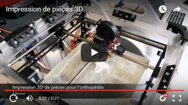 Impression 3D : OPR mêle nouvelles technologies et orthopédie