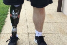 prothèse personnalisé à la jambe