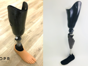 protheses de jambe et de cuisse fabriqués pour les personne amputés en bretagne et en normandie après une amputation