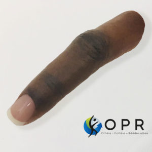 Prothèse de doigt esthétique en silicone pour agénésie partielle, amputation partielle orthopédie à Rennes et caen