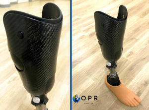 prothese tibiale en carbone et silicone à rennes en ile et vilaine et en normandie, prothèse de jambe après amputation