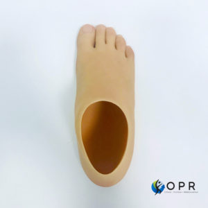 prothese de pied esthetique pour amputation partielle moignon au pied en ile et vilaine et dans la manche