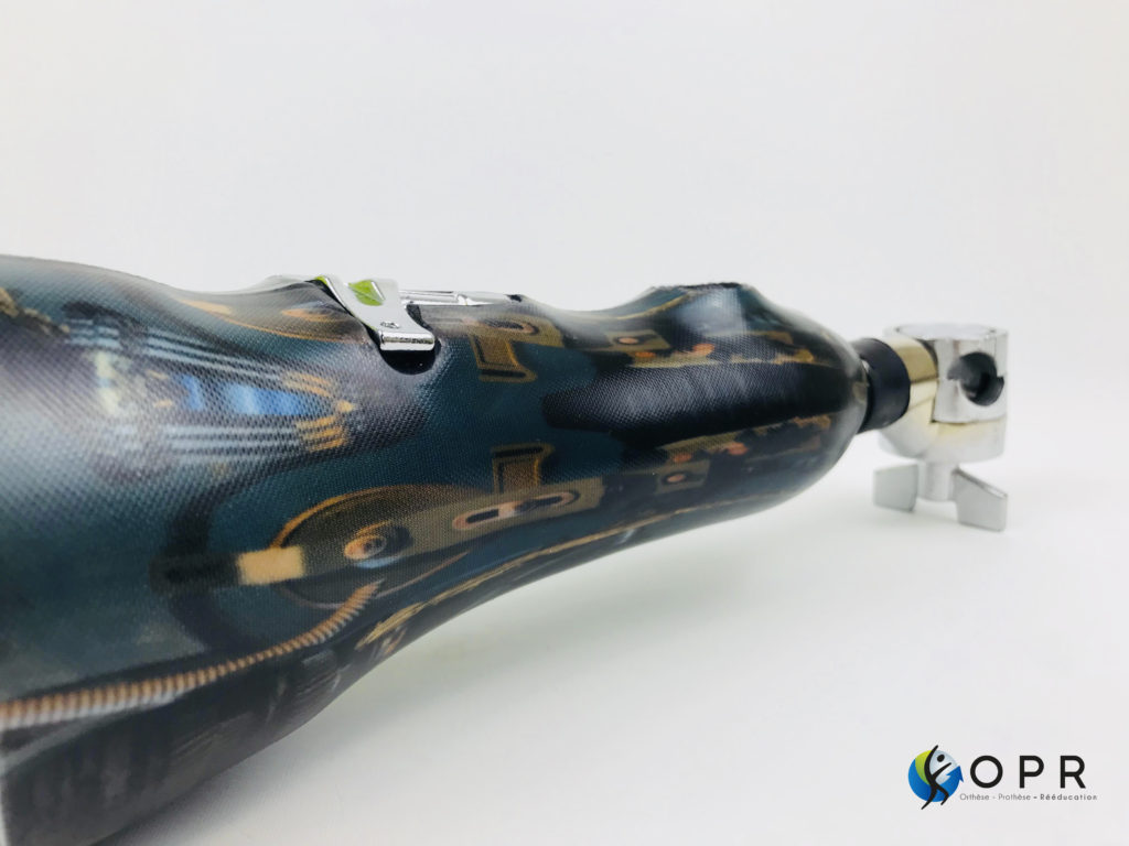 prothèse de bras pour faire de la batterie amputé en bretagne orthèse prothèse rééducation rennes normandie