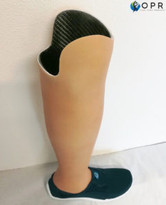 prothèse de tibia invisible avec revetement aqualeg en silicone réalisée par Orthèse prothèse rééducation, orthoprothésistes à Rennes