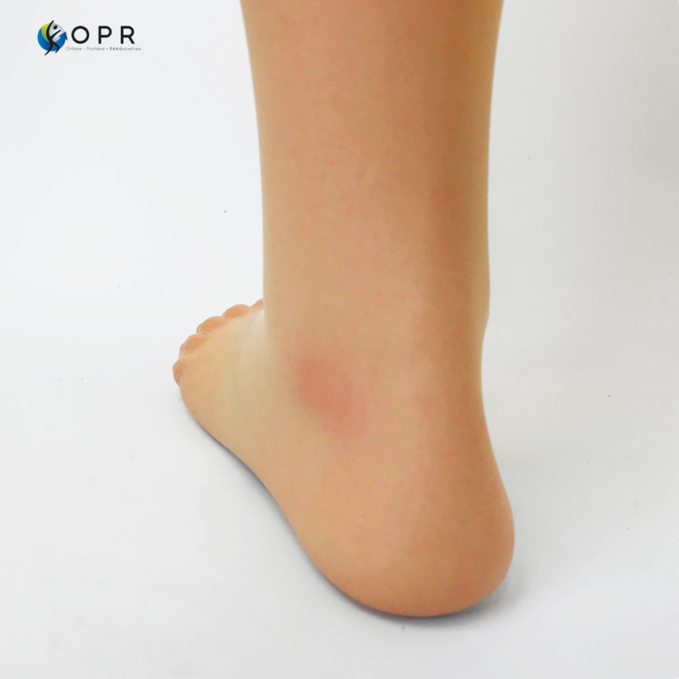 dream skin natural de l'entreprise oko solution pour des prothèses de jambe invisible en bretagne et en normandie près de avranches