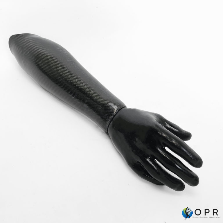 prothèse de main en carbone de couleur noire réalisée sur mesure pour un patient amputé au niveau du bras dans l'un de nos cabinets en bretagne et en normandie à rennes ou avranches