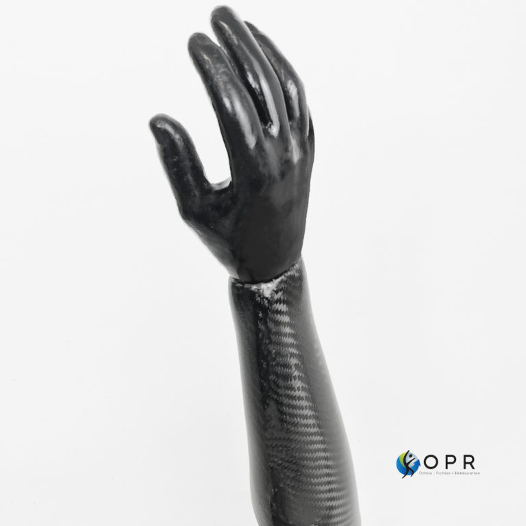 prothèse de main en carbone de couleur noire réalisée sur mesure pour un patient amputé au niveau du bras dans l'un de nos cabinets en bretagne et en normandie à rennes ou avranches