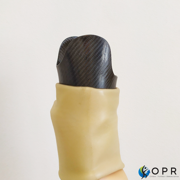 prothèse de jambe invisible grace aux esthétiques en silicone aqualeg dans les departement de la normandie entre avranches et caen 50