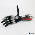 prothèse de bras en carbone avec une prothese de main mecatronique haute technologie pour les personnes amputés au poignet de saint lô, avranches et rennes en bretagne et en normandie