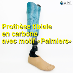 Prothèse tibiale en carbone avec motif personnalisé « Palmier » U-exist