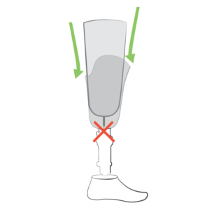 L'accroche dystal peut etre bloqué a cause d'un corp etranger au fond de l'emboiture. A tester avant d'appeler son orthoprothésiste