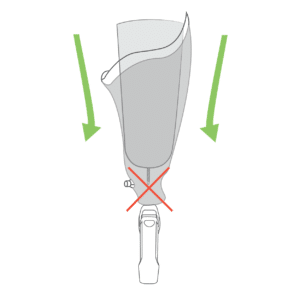 L'accroche dystal peut etre bloqué a cause d'un corp etranger au fond de l'emboiture. A tester avant d'appeler son orthoprothésiste
