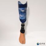 prothèse de jambe tibiale en carbone avec une personnalisation ocean u-exist en bretagne et en normandie