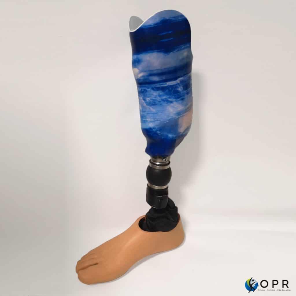 prothèse tibiale exosquelettique carbone - Nos produits