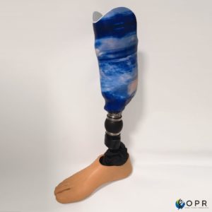 prothèse de jambe tibiale en carbone avec une personnalisation ocean u-exist en bretagne et en normandie