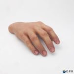 prothèse de main pour amputation partielle de la main ou des doigts, une prothèse esthétique réaliste en silicone en bretagne en ile et vilaine et dans la manche dans les établissements d'Arvanches et Saint Lo