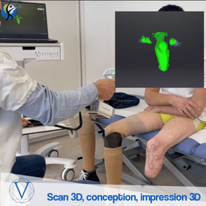 OPR utilise désormais VYTRUVE :  Scan et prothèses 3D.
