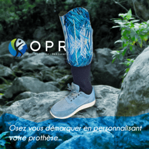 Comment OPR offre un design sur mesure pour votre prothèse : Une approche innovante de la prothèse